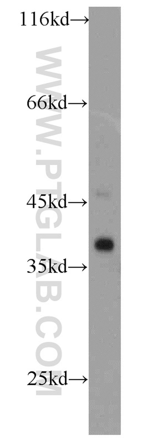 SMN Antibody in Western Blot (WB)