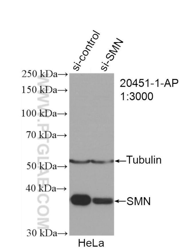 SMN Antibody in Western Blot (WB)