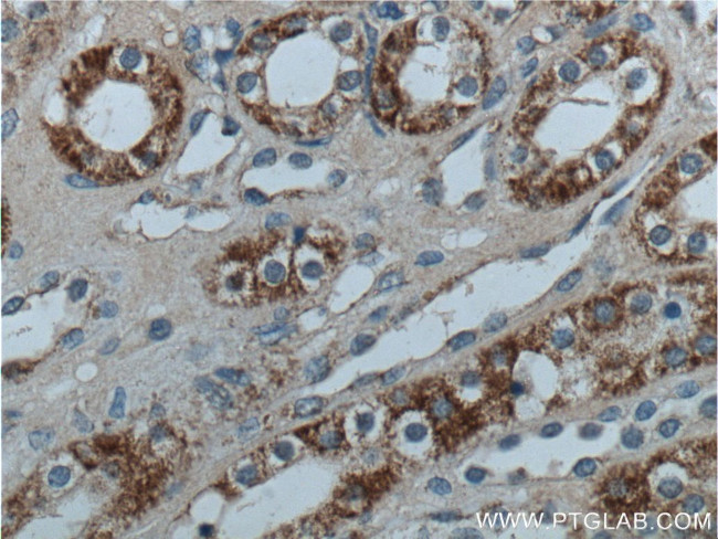 ALDH6A1 Antibody in Immunohistochemistry (Paraffin) (IHC (P))