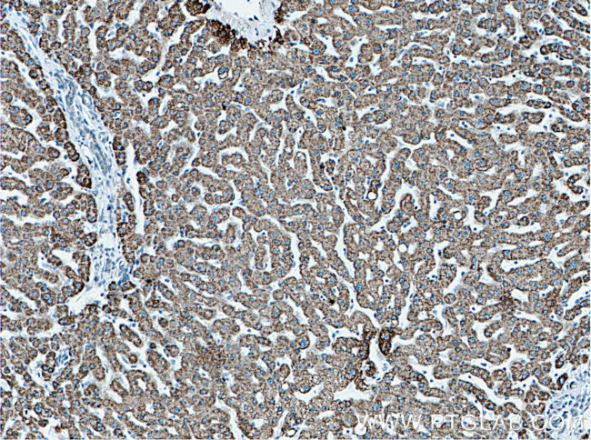 ALDH6A1 Antibody in Immunohistochemistry (Paraffin) (IHC (P))