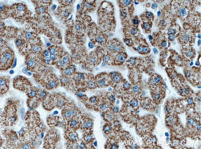 ALDH6A1 Antibody in Immunohistochemistry (Paraffin) (IHC (P))