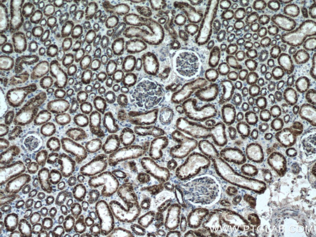 ALDH6A1 Antibody in Immunohistochemistry (Paraffin) (IHC (P))