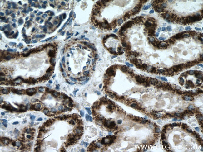 ALDH6A1 Antibody in Immunohistochemistry (Paraffin) (IHC (P))