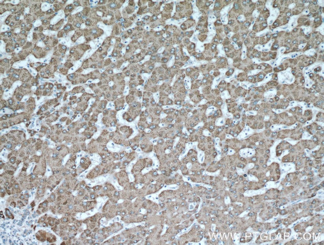 ALDH6A1 Antibody in Immunohistochemistry (Paraffin) (IHC (P))