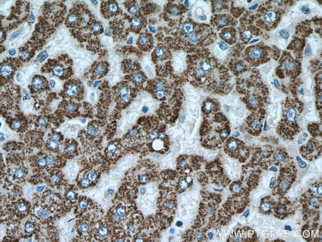 ALDH6A1 Antibody in Immunohistochemistry (Paraffin) (IHC (P))