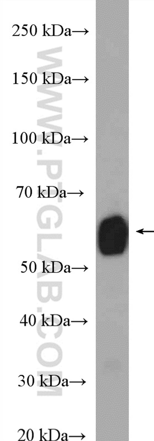 ALDH6A1 Antibody in Western Blot (WB)