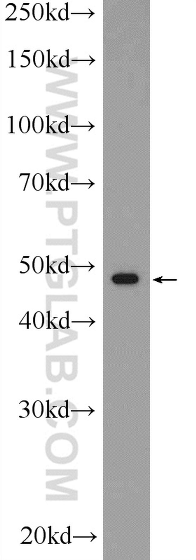 RAPSN Antibody in Western Blot (WB)