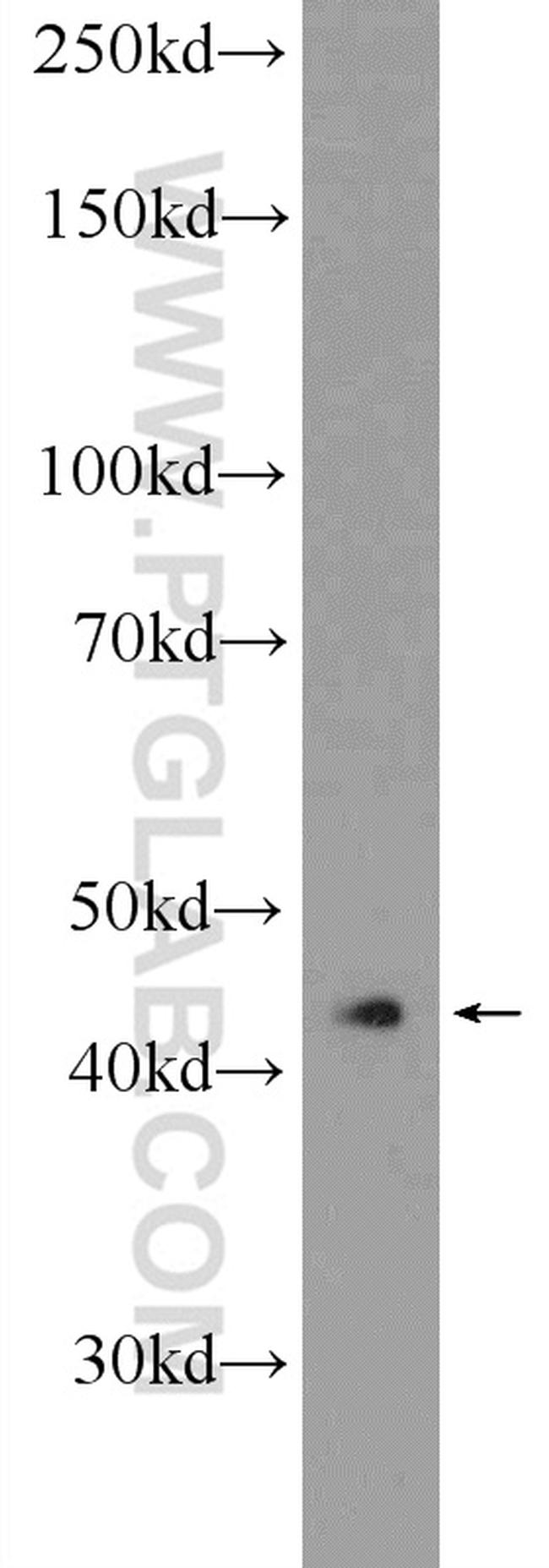 RAPSN Antibody in Western Blot (WB)