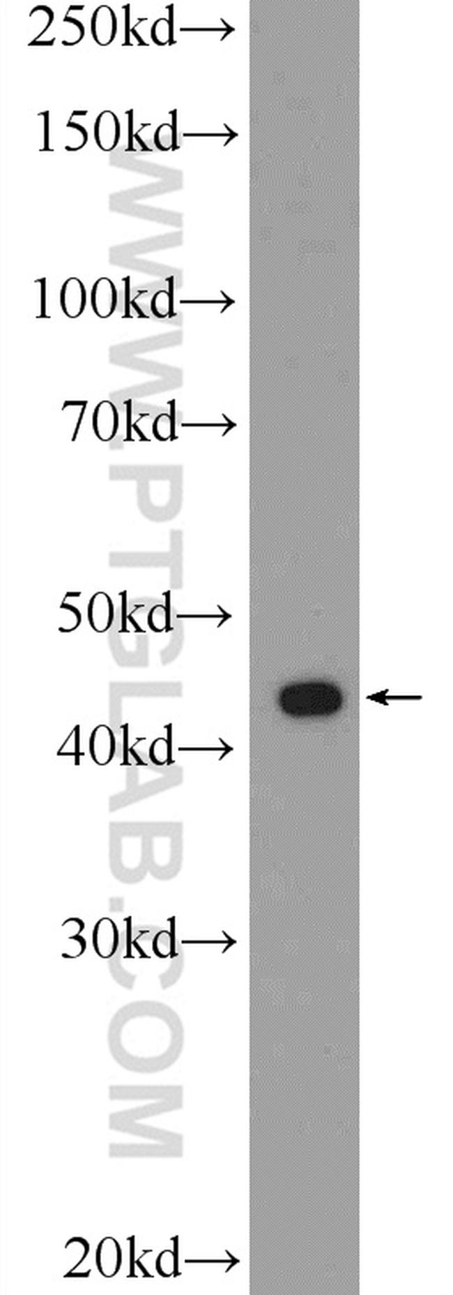 RAPSN Antibody in Western Blot (WB)