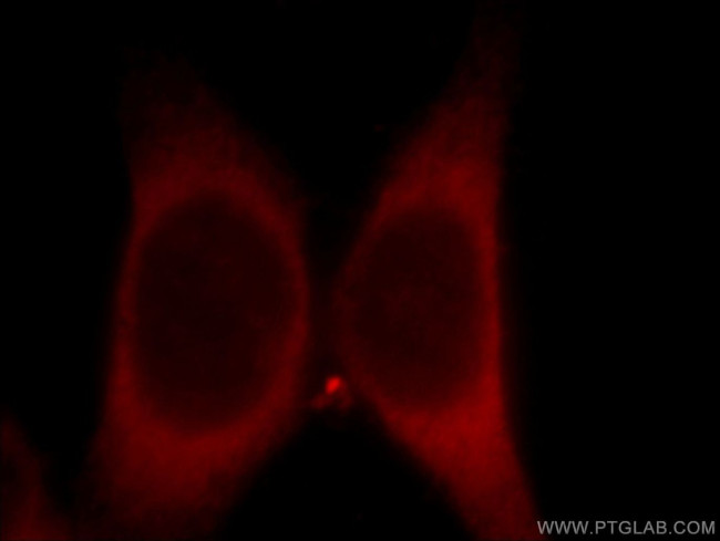 ZIP8 Antibody in Immunocytochemistry (ICC/IF)