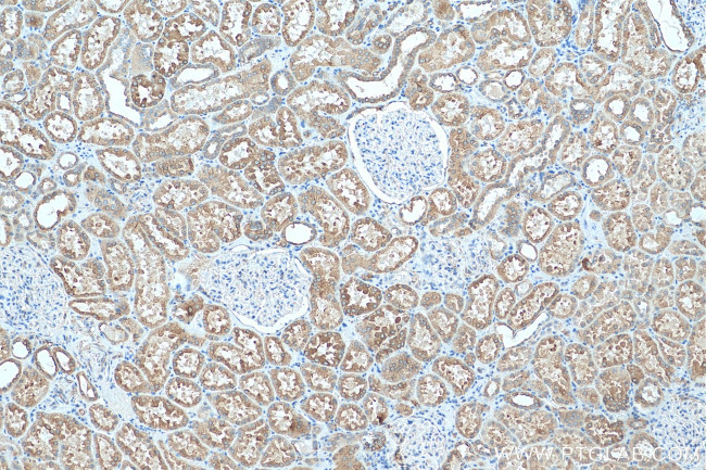 ZIP8 Antibody in Immunohistochemistry (Paraffin) (IHC (P))