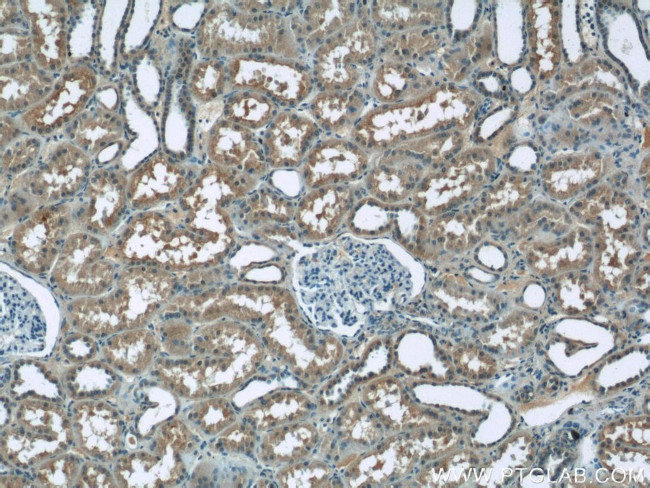 ZIP8 Antibody in Immunohistochemistry (Paraffin) (IHC (P))