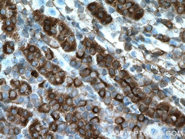 ZIP8 Antibody in Immunohistochemistry (Paraffin) (IHC (P))