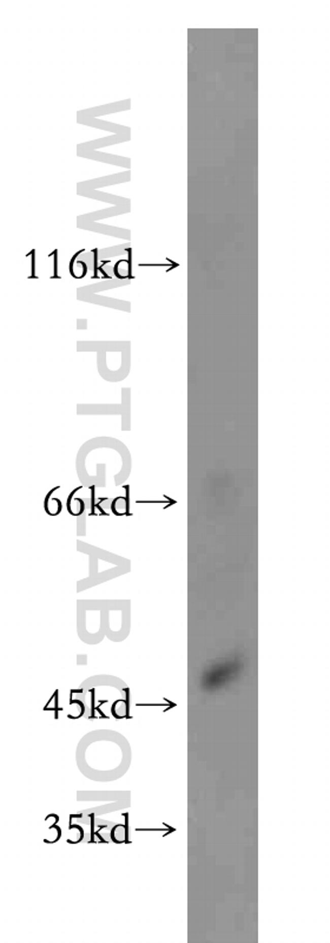 ZIP8 Antibody in Western Blot (WB)