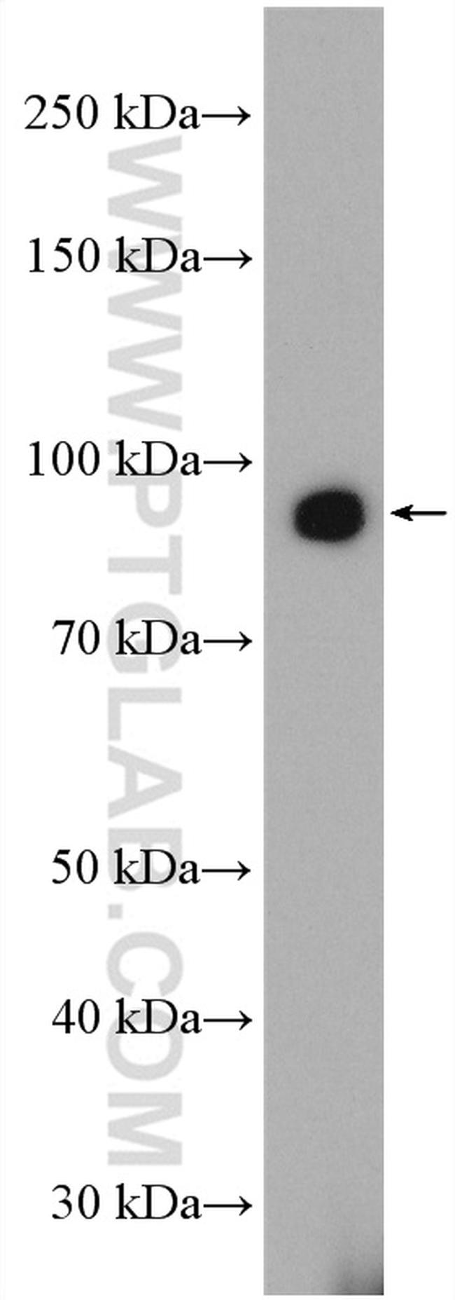 ZIP8 Antibody in Western Blot (WB)