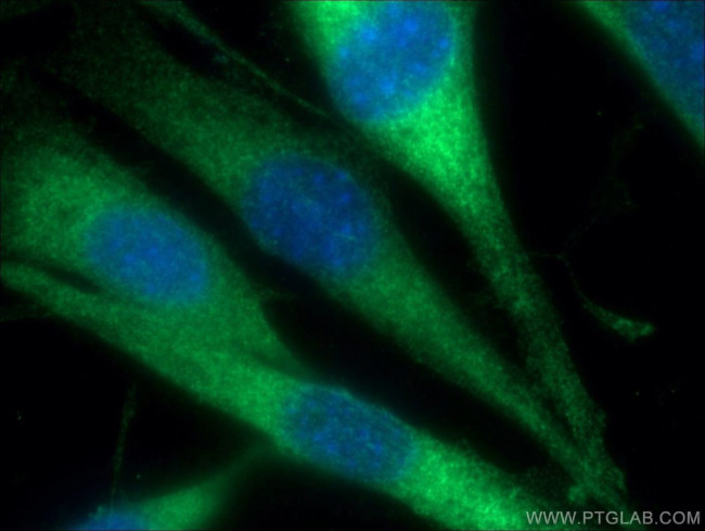 INF2 Antibody in Immunocytochemistry (ICC/IF)