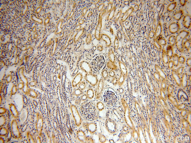 INF2 Antibody in Immunohistochemistry (Paraffin) (IHC (P))