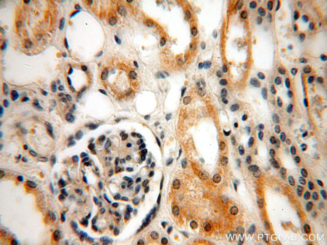 INF2 Antibody in Immunohistochemistry (Paraffin) (IHC (P))