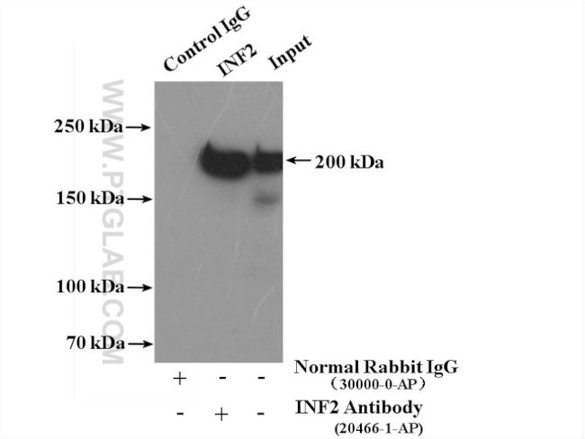 INF2 Antibody in Immunoprecipitation (IP)