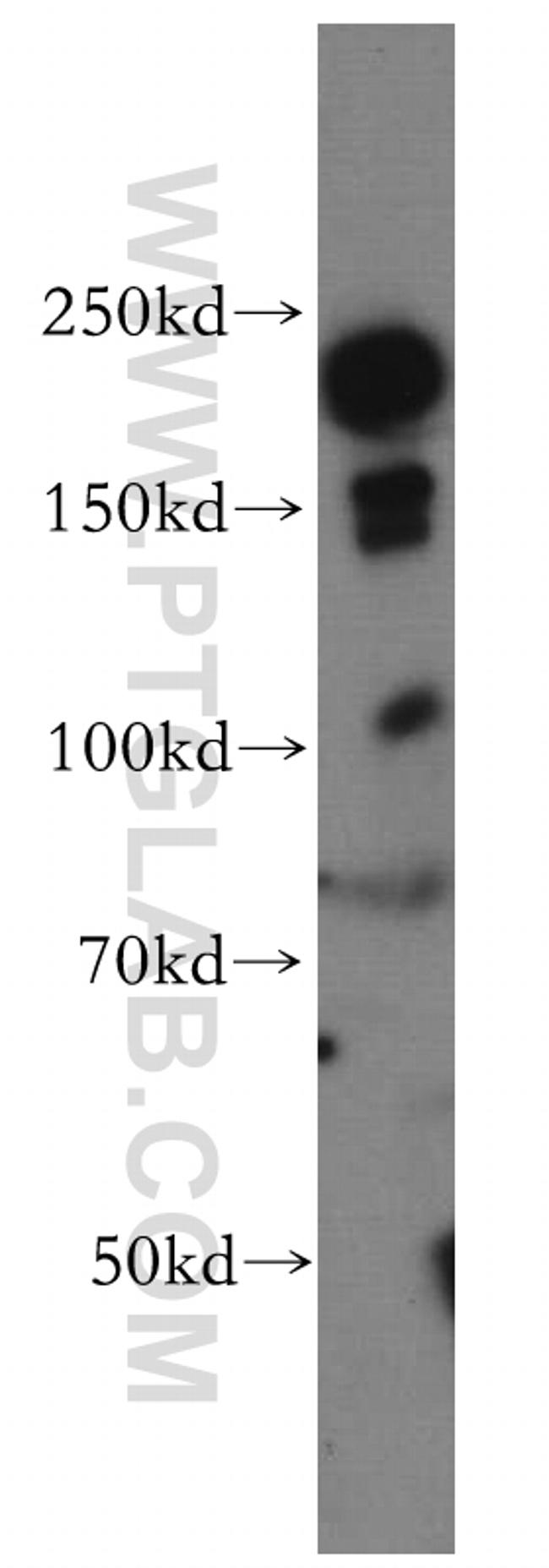 INF2 Antibody in Western Blot (WB)