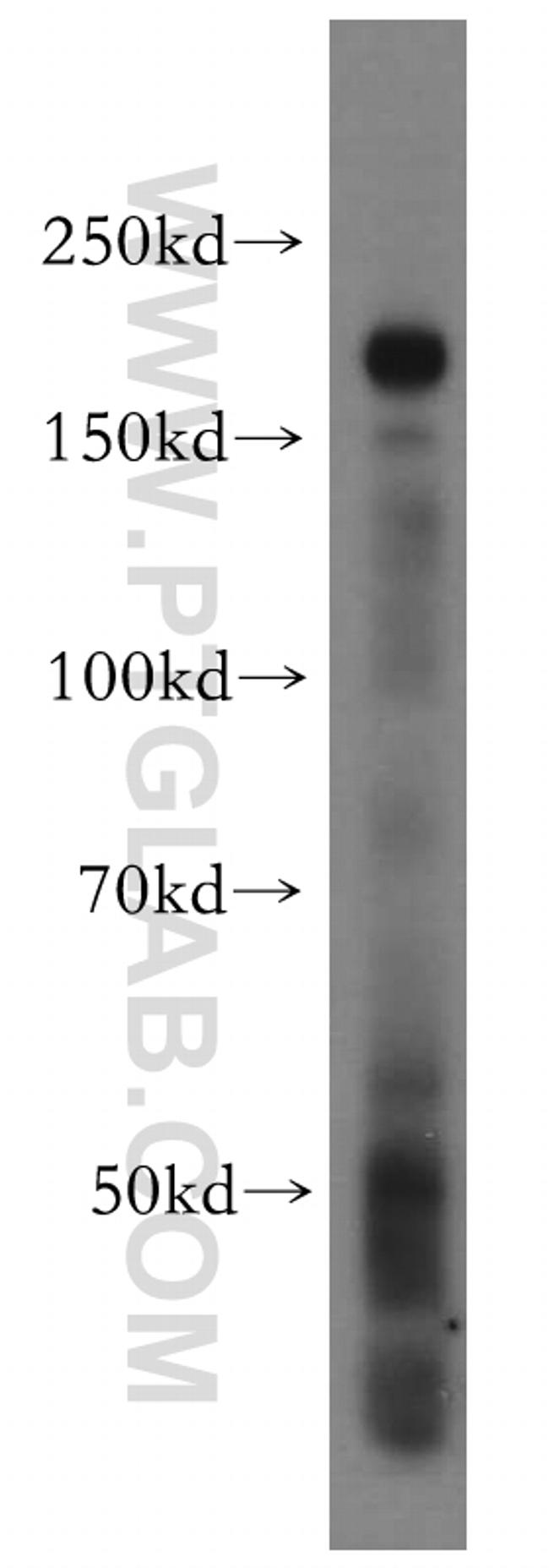 INF2 Antibody in Western Blot (WB)