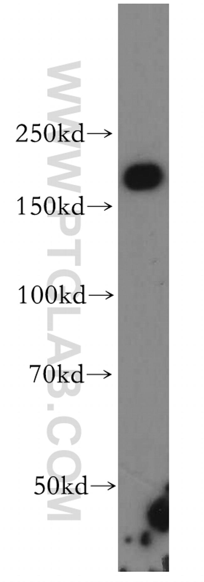 INF2 Antibody in Western Blot (WB)