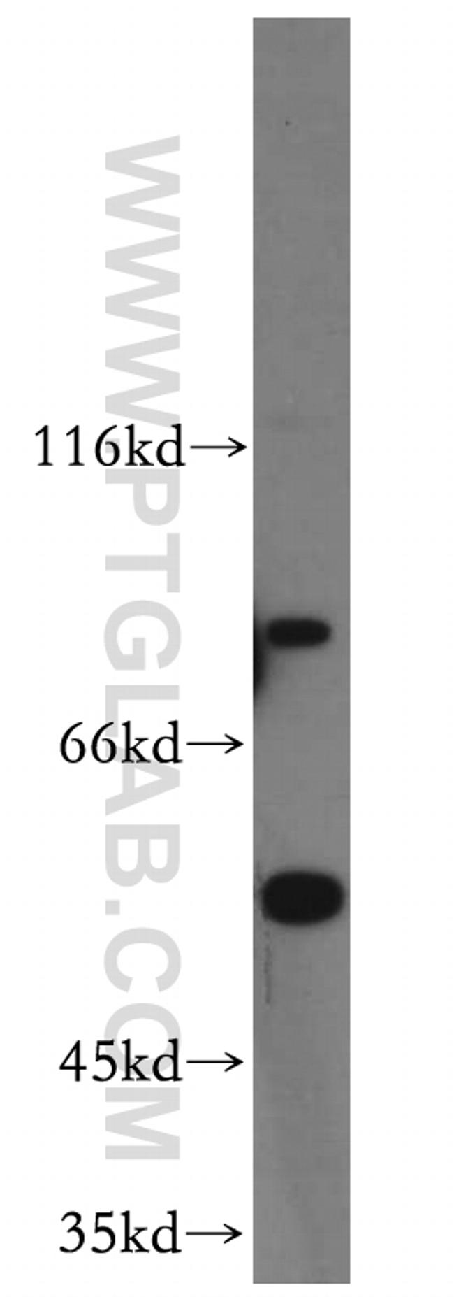 C9orf156 Antibody in Western Blot (WB)