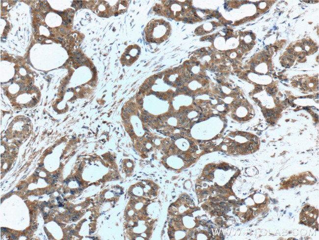 TBC1D17 Antibody in Immunohistochemistry (Paraffin) (IHC (P))