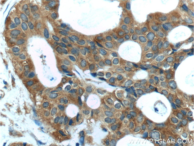 TBC1D17 Antibody in Immunohistochemistry (Paraffin) (IHC (P))