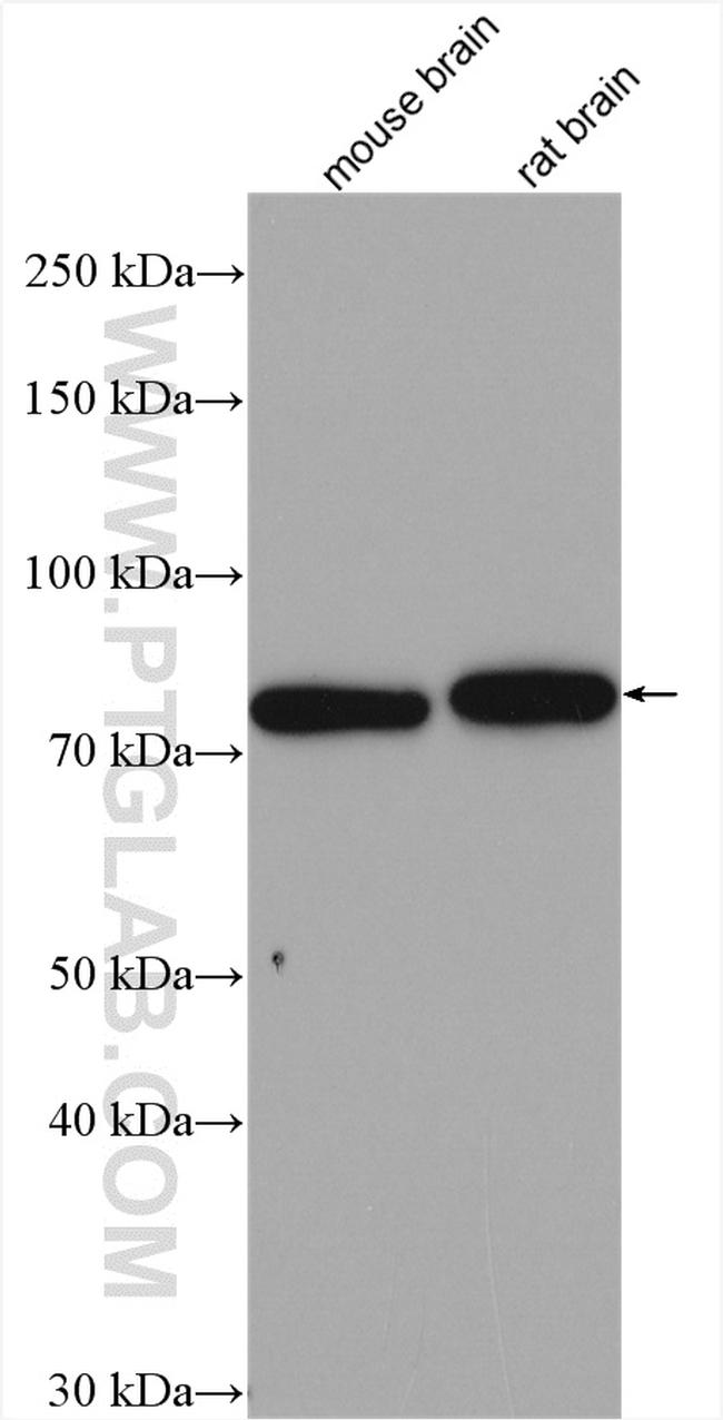 TBC1D17 Antibody in Western Blot (WB)