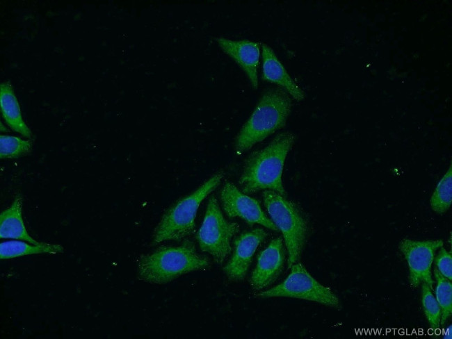 WDR32 Antibody in Immunocytochemistry (ICC/IF)