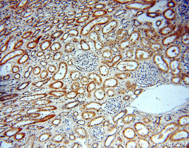 WDR32 Antibody in Immunohistochemistry (Paraffin) (IHC (P))