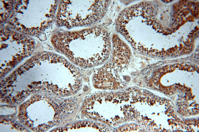 WDR32 Antibody in Immunohistochemistry (Paraffin) (IHC (P))