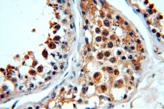 WDR32 Antibody in Immunohistochemistry (Paraffin) (IHC (P))