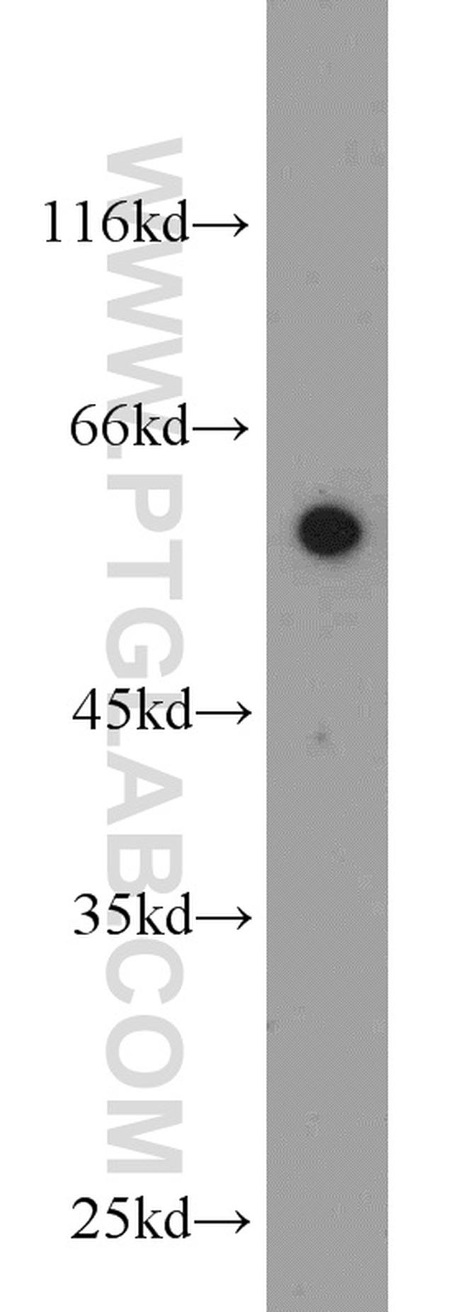 WDR32 Antibody in Western Blot (WB)