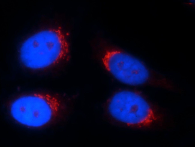 TMEM165 Antibody in Immunocytochemistry (ICC/IF)