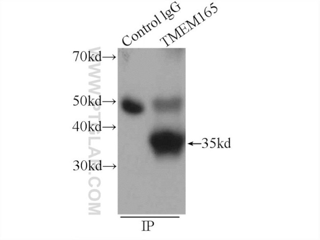 TMEM165 Antibody in Immunoprecipitation (IP)