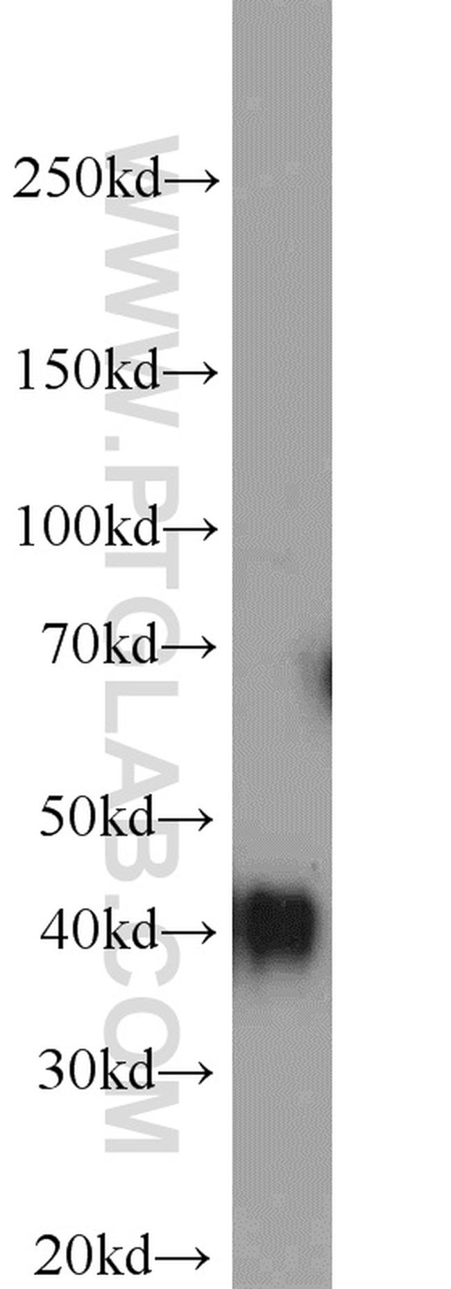 TMEM165 Antibody in Western Blot (WB)