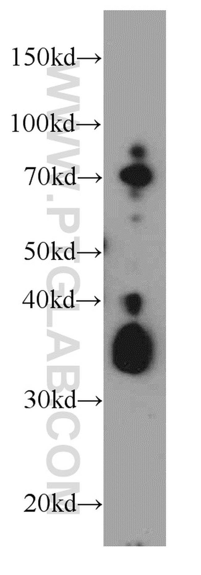 TMEM165 Antibody in Western Blot (WB)