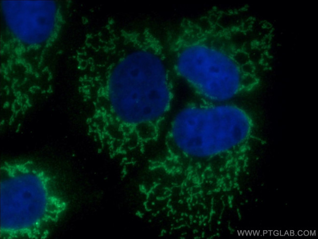 DAXX Antibody in Immunocytochemistry (ICC/IF)