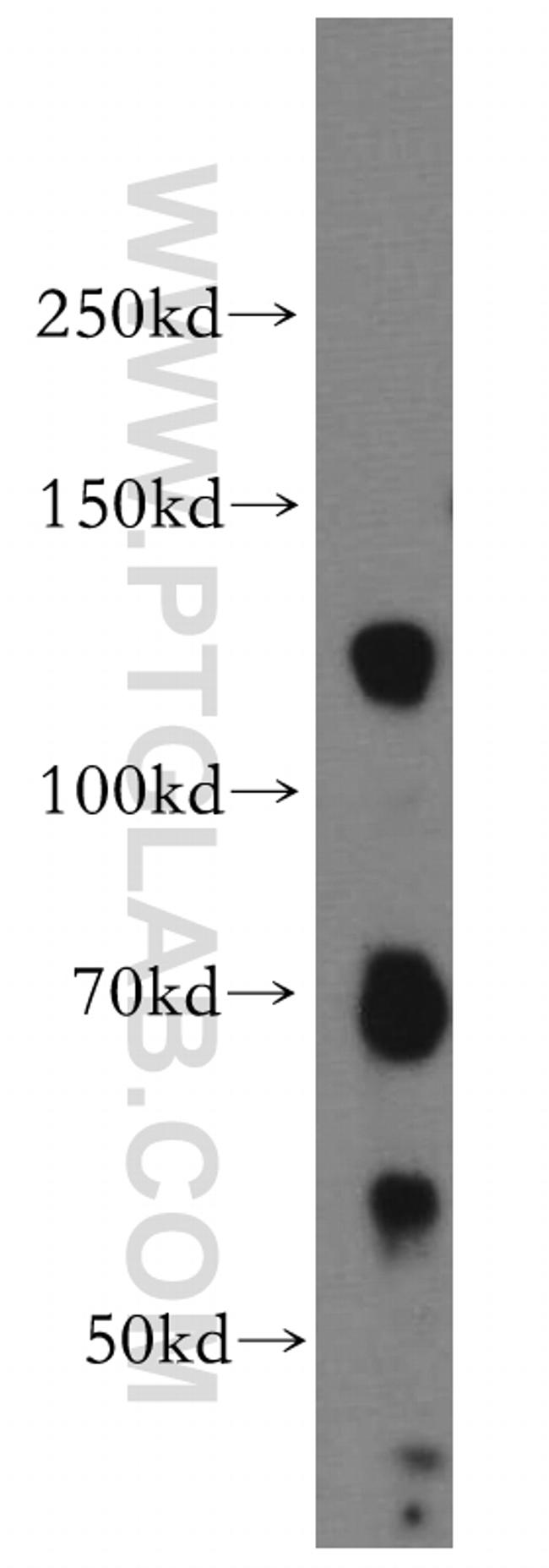 DAXX Antibody in Western Blot (WB)