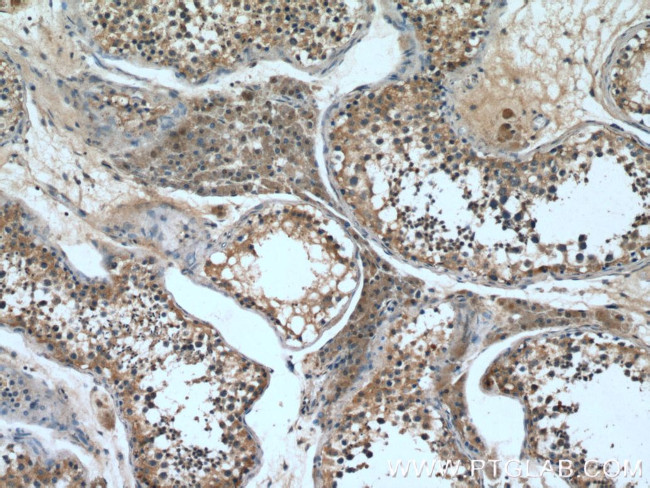 RAE1 Antibody in Immunohistochemistry (Paraffin) (IHC (P))