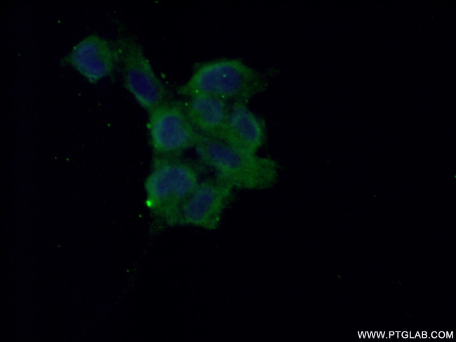 NME2 Antibody in Immunocytochemistry (ICC/IF)