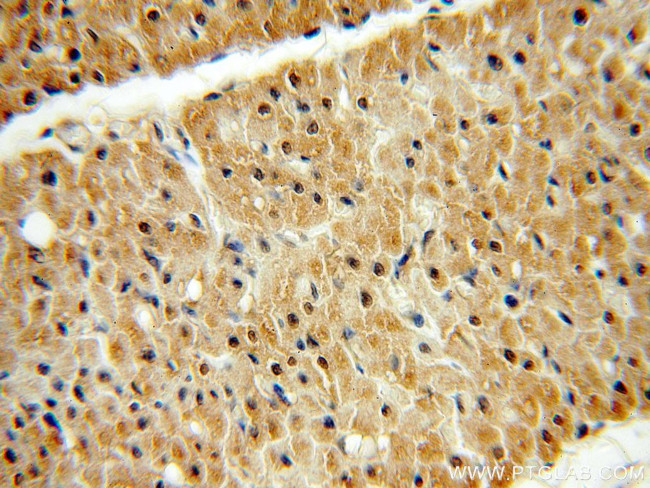 NME2 Antibody in Immunohistochemistry (Paraffin) (IHC (P))