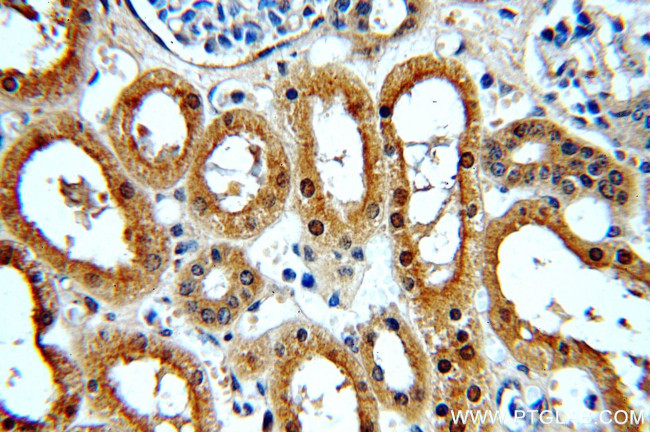 NME2 Antibody in Immunohistochemistry (Paraffin) (IHC (P))