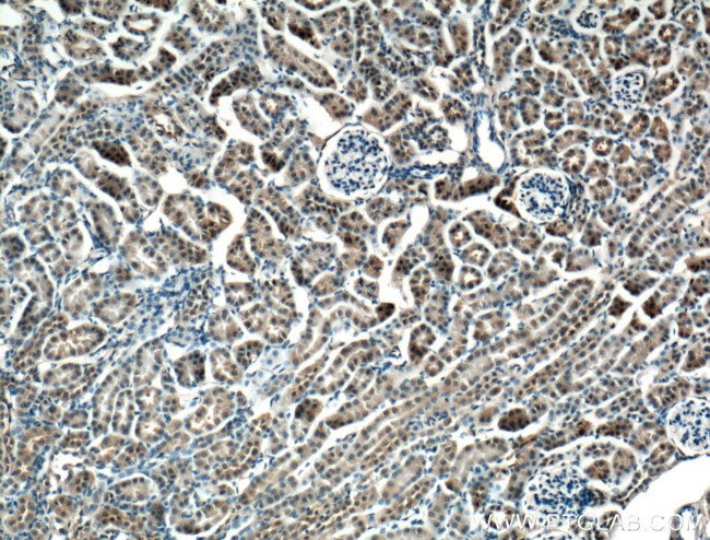 NME2 Antibody in Immunohistochemistry (Paraffin) (IHC (P))