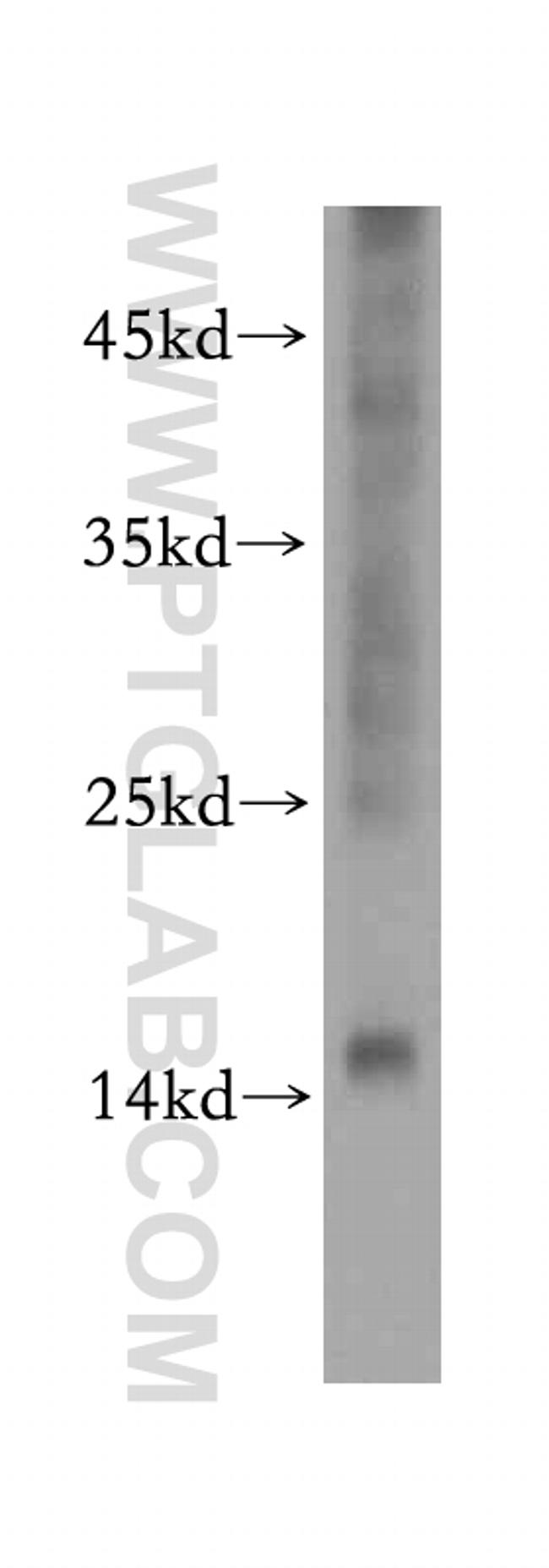 NME2 Antibody in Western Blot (WB)