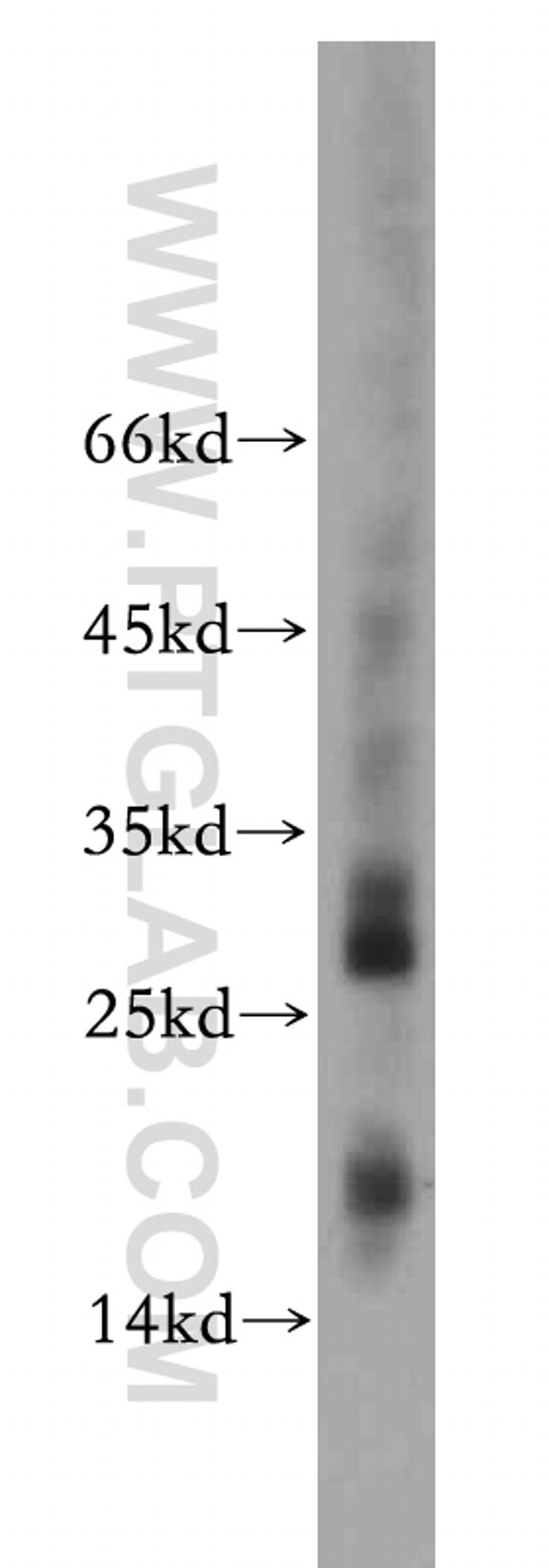 NME2 Antibody in Western Blot (WB)