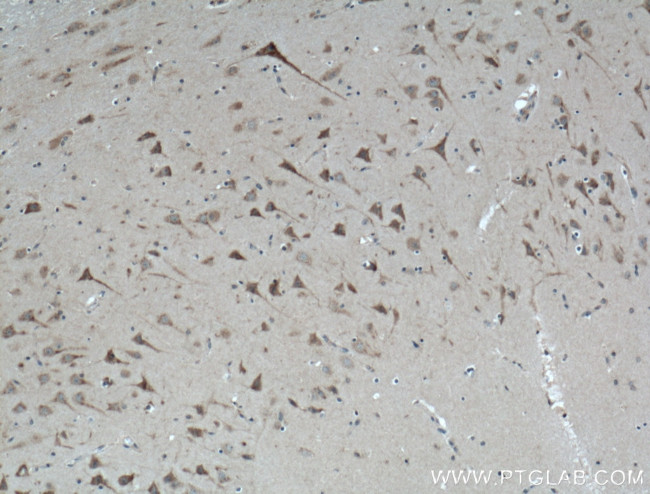 ABHD6 Antibody in Immunohistochemistry (Paraffin) (IHC (P))