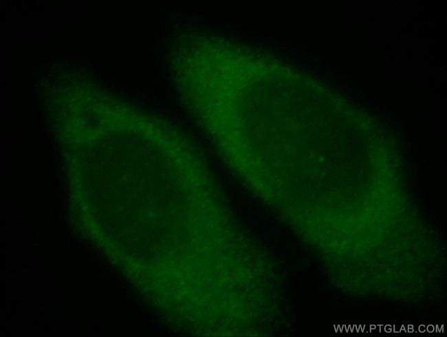 CEPT1 Antibody in Immunocytochemistry (ICC/IF)